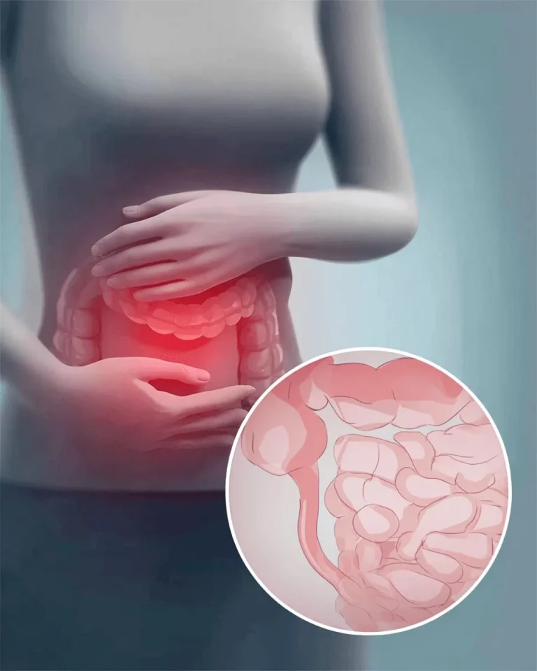Healthy gut microbiome with fermented foods and prebiotics for optimal gut health.